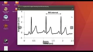 EKG RR Intervalleri ve Kalp Atım Hızı  Matlab  Ders 5 [upl. by Eilatam]