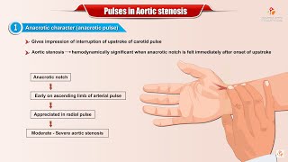 PULSES IN AORTIC STENOSIS  Usmle Cardiology [upl. by Zipporah]