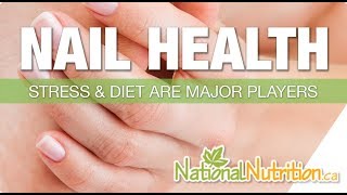 Natural Health Reviews  What Nails Say About Your Health Nail Health Signs  National Nutrition [upl. by Yuria461]