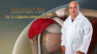 Bursitis Consejos Útiles y Tratamiento [upl. by Damiani]