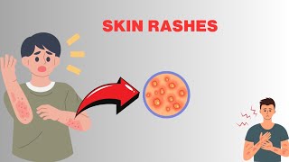 Skin rashescauses  diagnosis symptoms treatment [upl. by Wendalyn106]