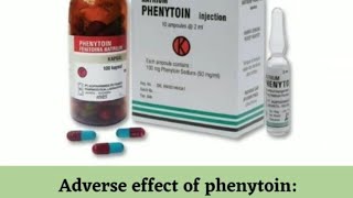 Phenytoin Adverse effects Mnemonic [upl. by Mozart]