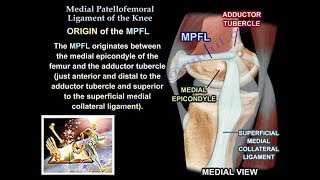 Medial Patellofemoral Ligament Of The Knee Anatomy Everything You Need To Know  Dr Nabil Ebraheim [upl. by Learsiy]