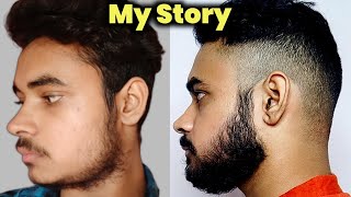 My Story Patchy Beard To Full Beard Naturally  Fix Patchy Beard Naturally  Beard Growth Reality 😯 [upl. by Allehcim838]