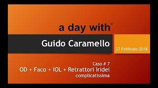 27 feb 2018 ADW Guido Caramello  caso7 [upl. by Livi]