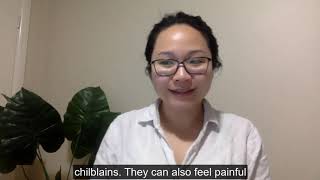 Chilblains  What they are and how to treat them [upl. by Vallery818]