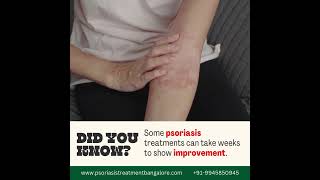 Why Do Psoriasis Treatments Take Time psoriasis psoriasisawareness [upl. by Lemert357]