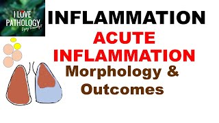 INFLAMMATION Part7 MORPHOLOGY amp OUTCOMES of Acute Inflammation [upl. by Kalam697]