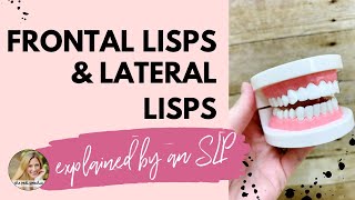 FRONTAL LISP VS LATERAL LISP explained by an SLP [upl. by Ayeki]