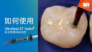 如何使用 UltraSeal XT™ hydro™ 亲水性窝沟封闭剂 [upl. by Asiak]