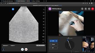 Teach the eFAST exam remotely 44  Subxiphoid Cardiac [upl. by Chladek]