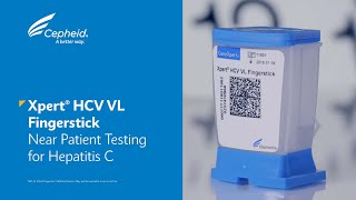 XpertR HCV VL Fingerstick  Near Patient Testing for Hepatitis C [upl. by Yk750]