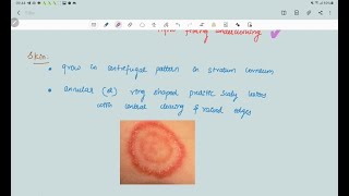 Dermatophytosis  Fungal infection  Microbiology  Handwritten notes [upl. by Avla]