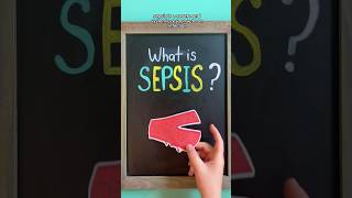 🦠 SEPSIS OVERVIEW [upl. by Anthia]