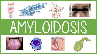 Understanding Amyloidosis [upl. by Abelard494]