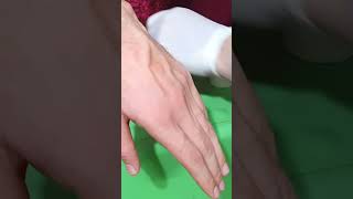 How to Insert IV Cannula  IV Cannulation Technique  Branula  Intravenous Catheter [upl. by Meggy]