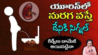 Dr Movva Srinivas  యూరిన్ లో నురగ వచ్చేవారికి హెచ్చరిక Unknown Facts Urine  Foamy Urine Kidney [upl. by Elagiba494]