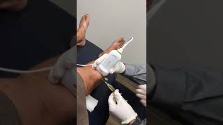 Prepatellar Bursa Aspiration  Elite Sports Medicine  Lethbridge [upl. by Aikemot514]