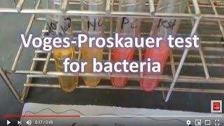 V PVogesProskauer Test for bacteria [upl. by Agathy]