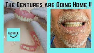 Denture delivery visit [upl. by Dumah]