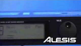 Alesis DM5 Pro Drum Kit Surge Cymbals [upl. by Nennarb143]