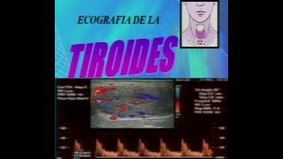 ECOGRAFIA DOPPLER DE TIROIDES [upl. by Rutherford]