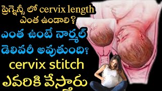 what is the normal cervix length during pregnancy  cervix length during pregnancy chart in telugu [upl. by Mariko615]