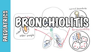 Bronchiolitis causes pathophysiology signs and symptoms treatment [upl. by Lasala]