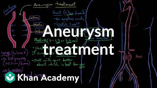 Aneurysm treatment  Circulatory System and Disease  NCLEXRN  Khan Academy [upl. by Pascia565]