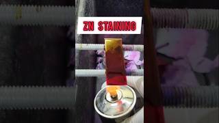 ZN Staining or Ziehl Neelsen staining shorts staining [upl. by Holmann905]