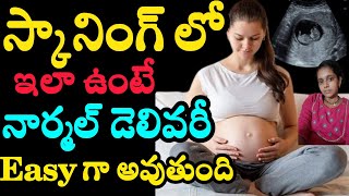 normal delivery scan report in telugu [upl. by Ydrah]