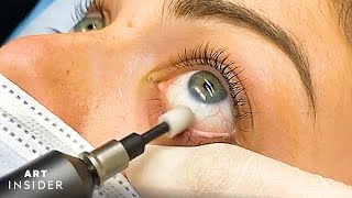 Eyelid Microexfoliation Cleanses Your Eyes [upl. by Maccarthy]