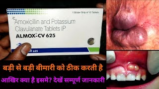 almox cv 625 tablets uses in hindi amoxycillin and potassium clavulanate tablets uses in hindi [upl. by Cullin]