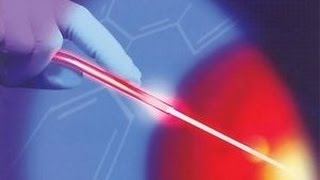 Krampfadern mit Laser behandeln [upl. by Oniger]