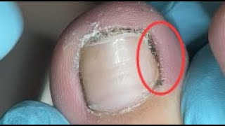 Best toenail dirt Cleaning [upl. by Kaya]