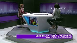 Entretien  Sensibilisation à lalbinisme pour le mieux être des albinos [upl. by Uttasta]