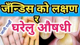 जन्डिस को लक्षण र घरेलु औषधी Symptoms of Jaundice  Nepali Health Tips [upl. by Jarrad420]