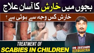 bachon main karish ka asan ilaj  Treatment of scabies explained in detail  Scabies [upl. by Nasaj]