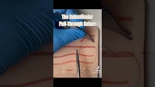 The Suture all adults and children love suture nursepractioner doctor sutures medicalschool [upl. by Bowen]