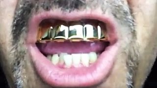 Eight Tooth Grillz Fitting Instructions [upl. by Tterrej]