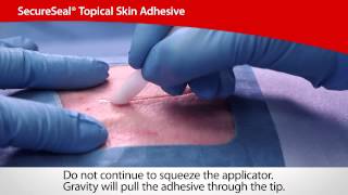 SecureSeal® Topical Skin Adhesive  Cardinal Health [upl. by Lauretta]