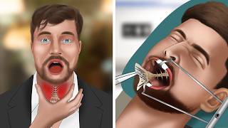 ASMR Animation Remove fish bones stuck in MrBeasts throat [upl. by Amalbergas457]