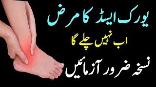 Easy Treatments for Uric Acid and arthritis  Joint Pain and Gout In Urdu Hindi [upl. by Land612]