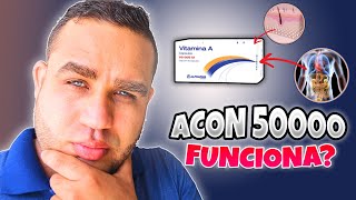 ACON 50000 VITAMINA A RETINOL PARA QUE SIRVE  DEBES SABER ESTO [upl. by Patt]