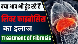 Liver Fibrosis Ka Ilaaj Kaise Kare FAST TRACK Your Recovery  Liver Fibrosis Treatment in Hindi [upl. by Samtsirhc]