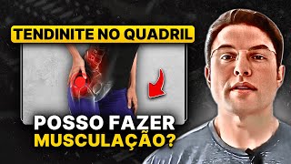 Tendinite No Quadril x Musculação  Muzy Explica [upl. by Dibri523]