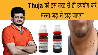 Thuja इस तरह से उपयोग करें मस्सा जड़ से झड़ जाएगा  Warts  Homeopathic Medicine  How to use [upl. by Effy]