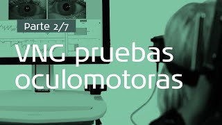 VNG pruebas oculomotoras parte 27 Porqué realizar un examen oculomotor [upl. by Netsrijk]