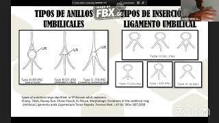 Anatomia pelvica laparoscopia aplicada a la cirugía [upl. by Yeltihw608]