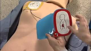 Physio Control LifePak CR Plus Demo [upl. by Latsyrcal]